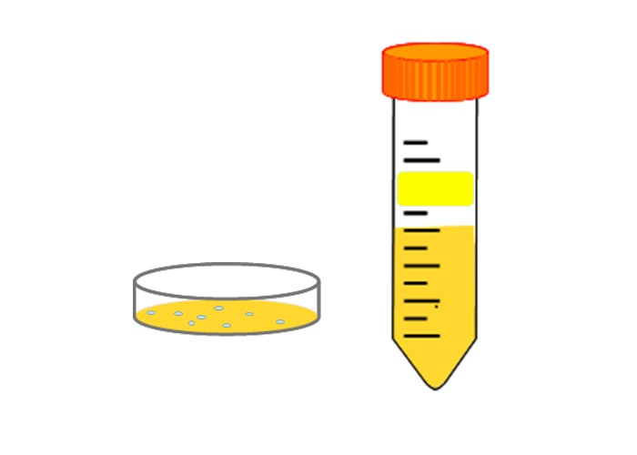 Buy cheap DNA Extraction Plasmid DNA Preparation product