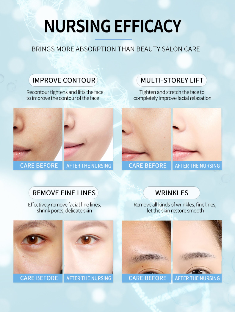 10 cartridges Hifu 7D Machine Body Face Lifting and HIFU 2 in 1 portable rf face lifting skin tightening machine