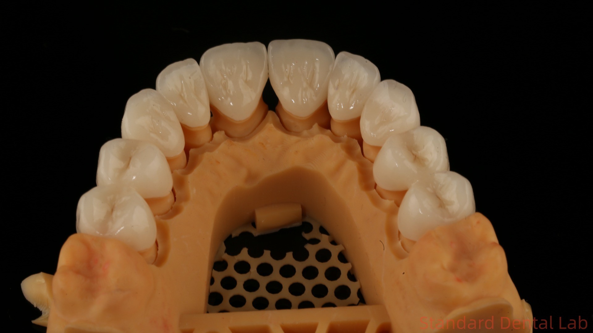 Full Contour Dental Lab Crowns High Translucency Solid Zirconia Crown China Dental Lab