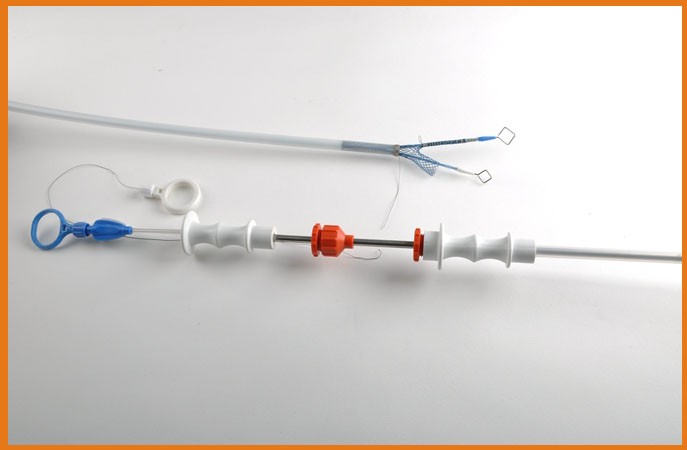 Nitinol Esophageal Stent