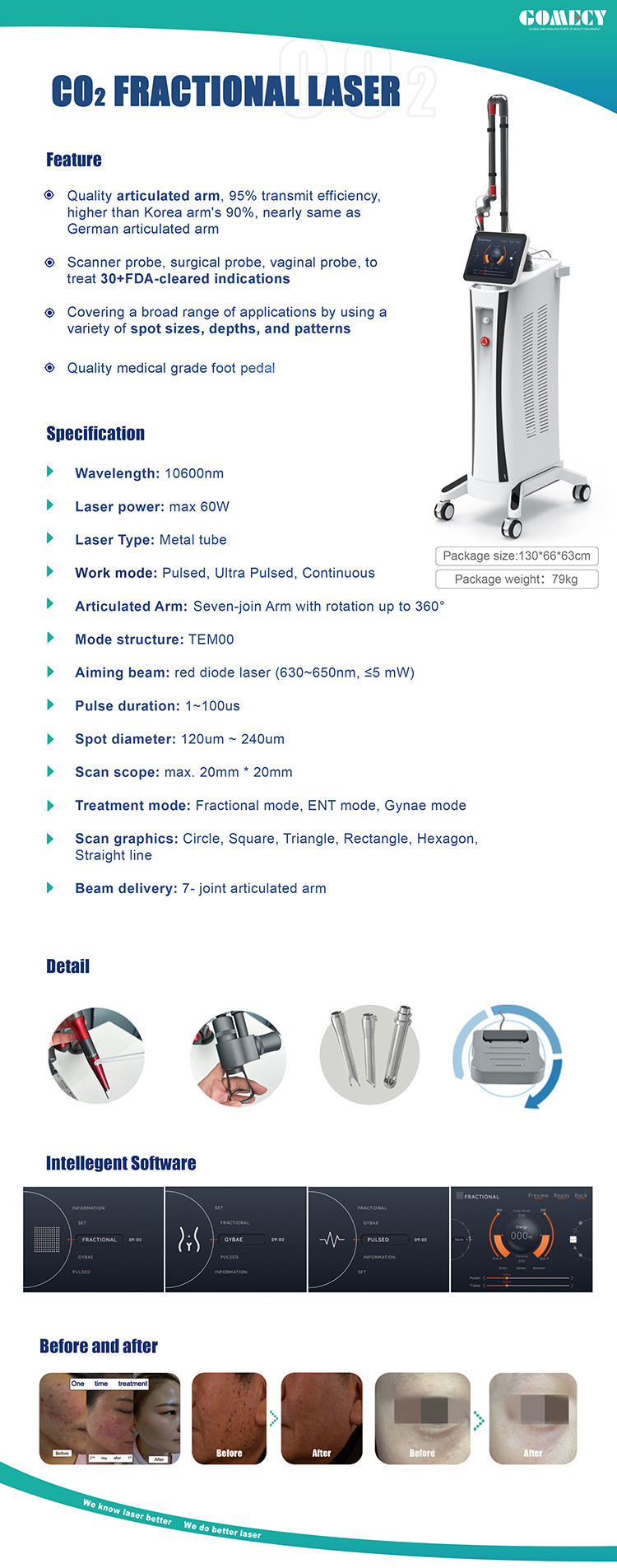 GOMECY 2024 Facial Skin Care Co2 Fractional Laser Stretch Mark Fractional Co2 Laser For Warts Scars Birthwarks Removal