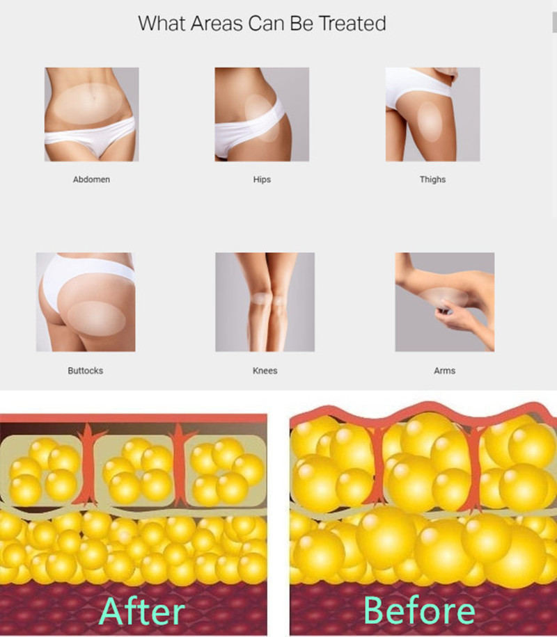 Low Intensity Shockwave Therapy Machine For Clinic Erectile Disfunction treatment