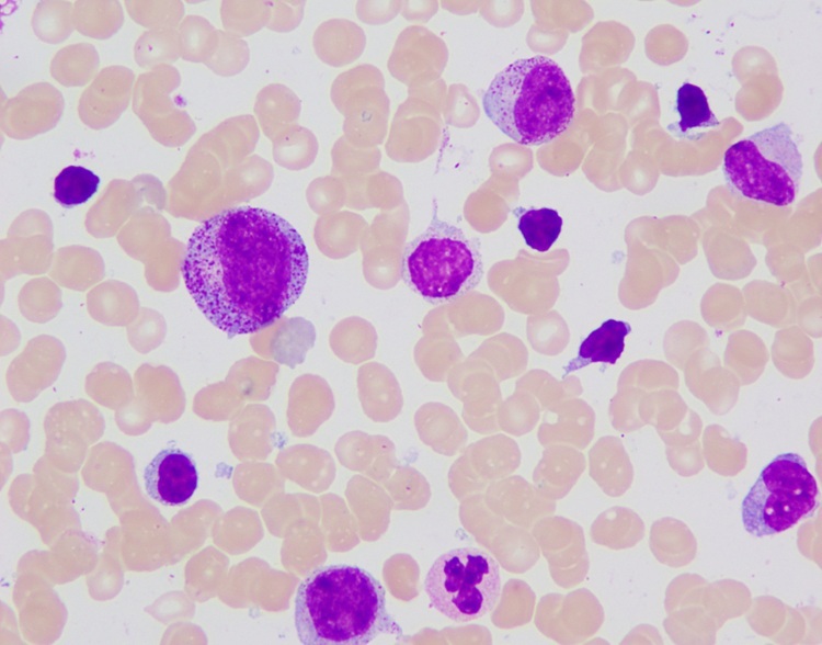 Hospital / Research Institution Wright Giemsa Stain Solution For Auto Stainer
