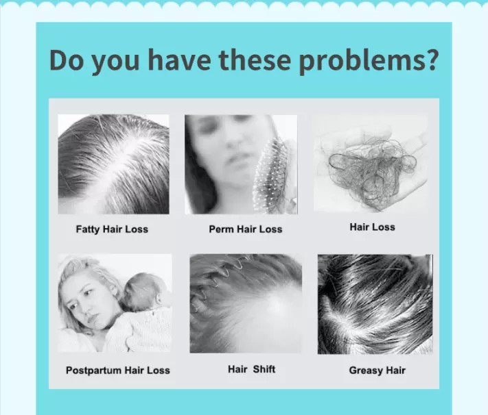 ISO Laser Hair Growth Helmet 8000B Kernel Medical Equipment