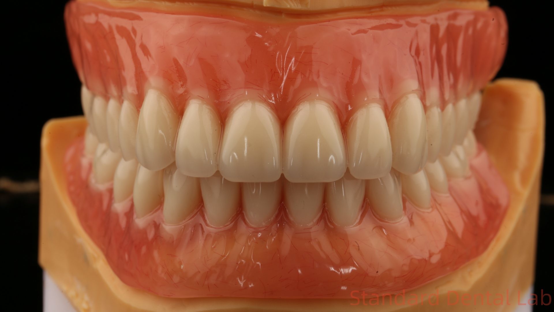 Heat Cured Ivoclar Full Acrylic Denture Dental Lab High Accuracy High Esthetic Advantage