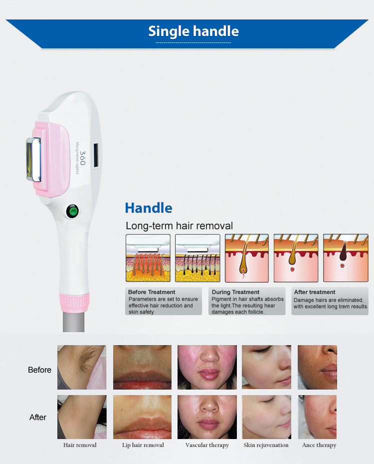 Magnetic Ipl Shr OPT Laser Hair Removal Machine 640nm Photo Rejuvenation