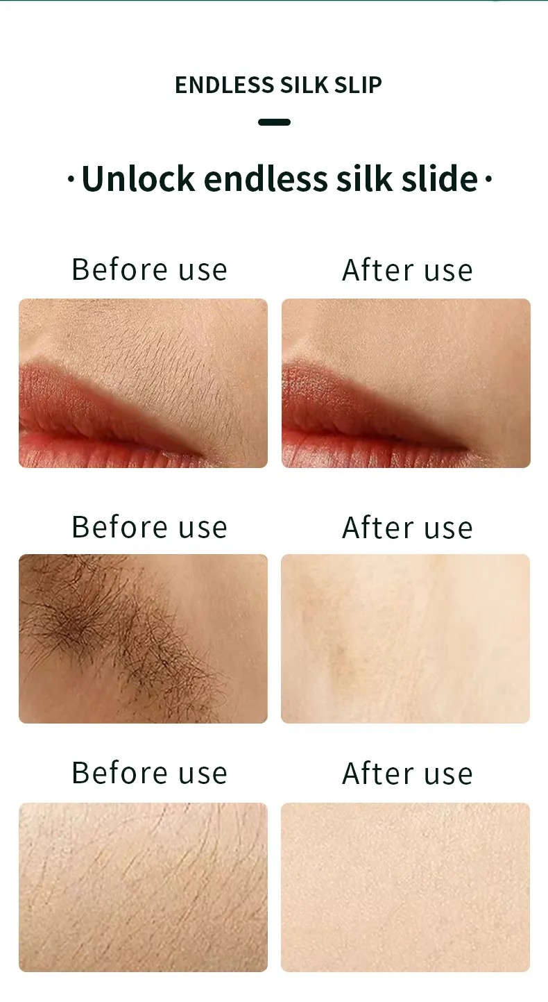 Ice Cool Permanent IPL Hair Removal Device for Women Men, ,Whole body Hair Remover As Fast As 8 Minutes, 999，999 Flashe