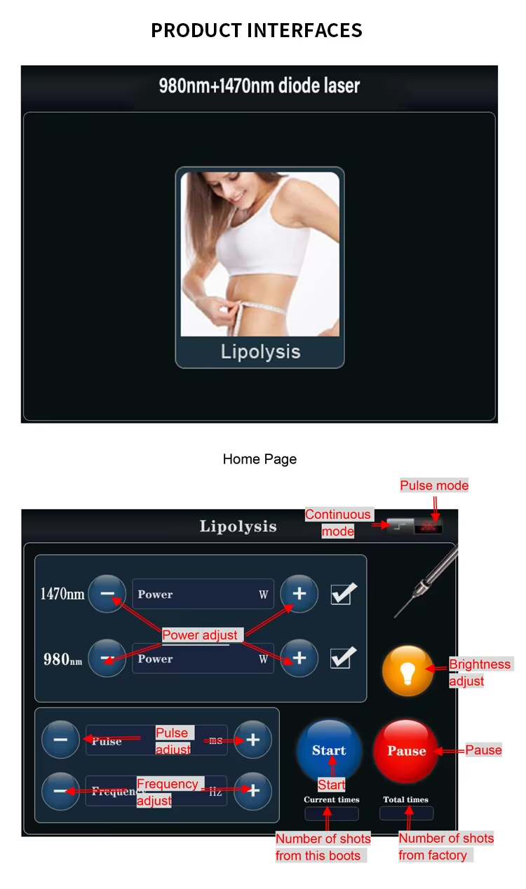 980nm 1470nm Diode Laser Gynecology Vaginal Tightening Surgery Laser