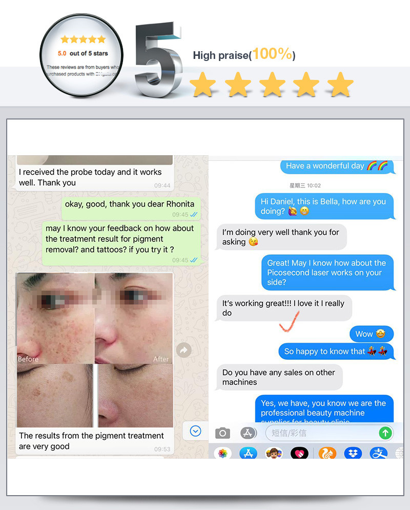 Colorful Birthmark Pigmentation Removal Laser Machine Pico Second 3000W