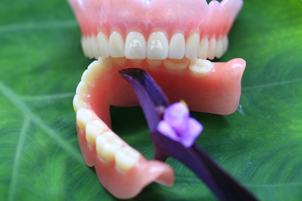 Full Arch Acrylic Partial Denture