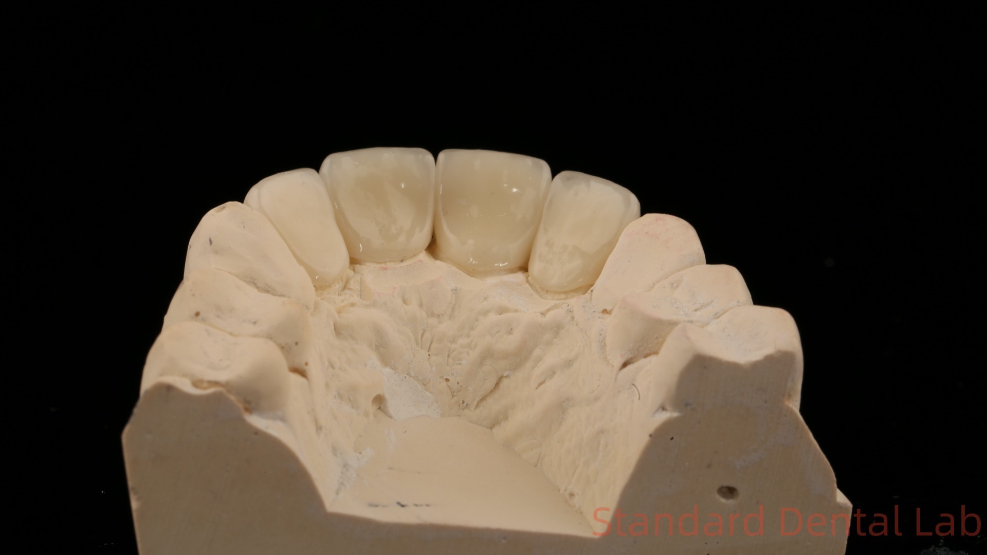 Strong Layered Zirconia Crown And Bridge In Good Esthetics Zirconia Layered China Dental Lab