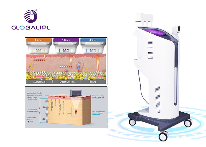 Ultrasound Face Lifting HIFU Machine 25000 Shots Self Developed Patent Technology