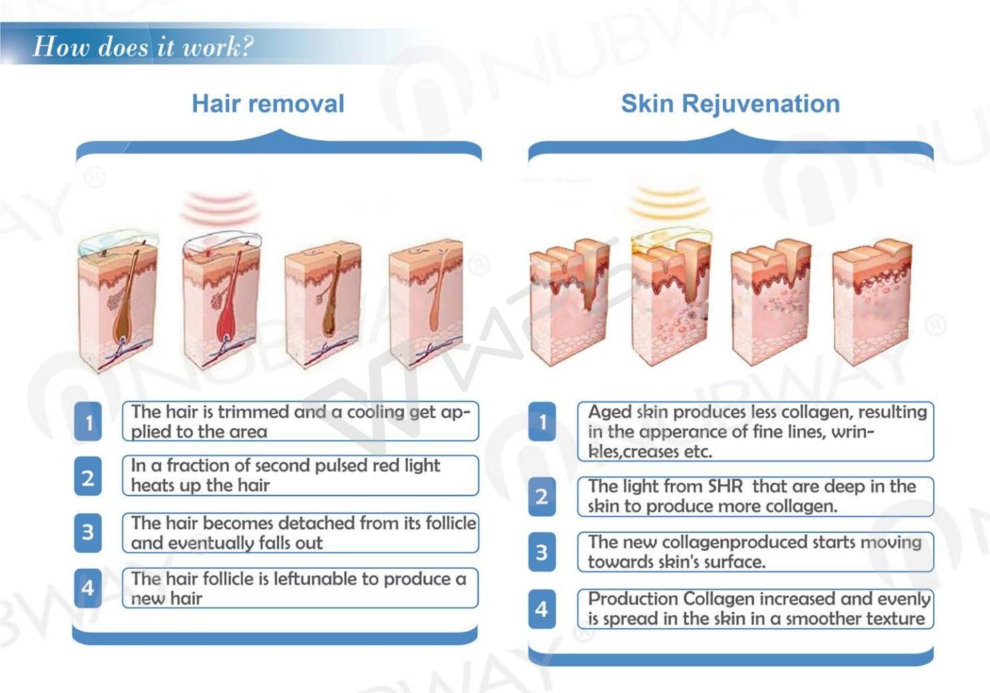 Multifunctional soprano diode laser skin hair removal ipl machine intense pulsed light machine