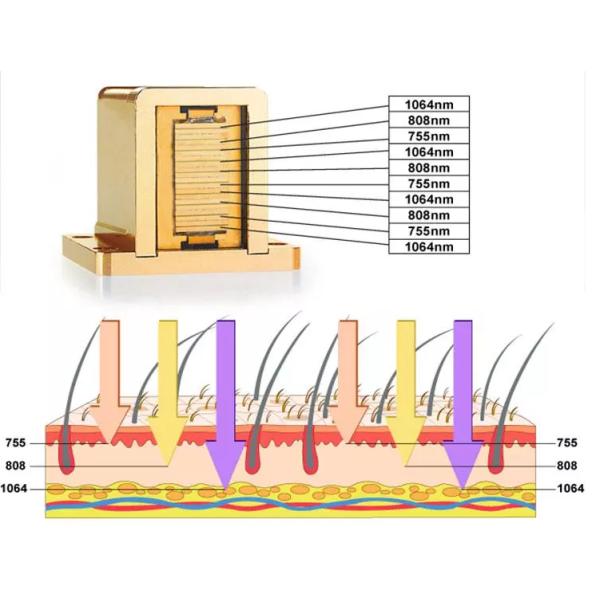 Alexandrite laser Germany Laser Bars 755/808/1064nm triple wavelengths diode laser hair removal machine