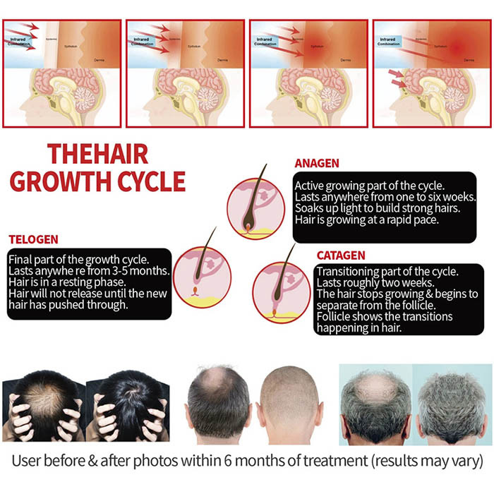 Portable Infrared Light Therapy Helmet For Hair Loss Benefits Growth