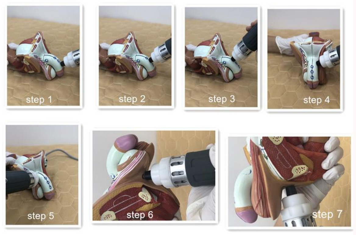 50mj To 200mj ESWT Shockwave Therapy Machines C Mode P Mode