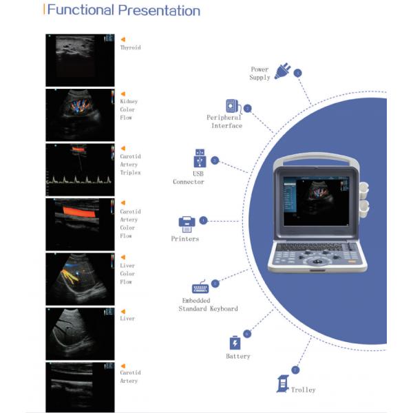 2d /3d/4d Medical Ultrasound Machine
