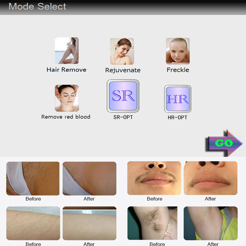 OPT Laser IPL Hair Removal Machine 590nm 640nm Skin Rejuvenation
