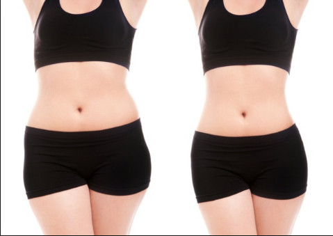 Cryolipolysis Fat Freeze Slimming Machine