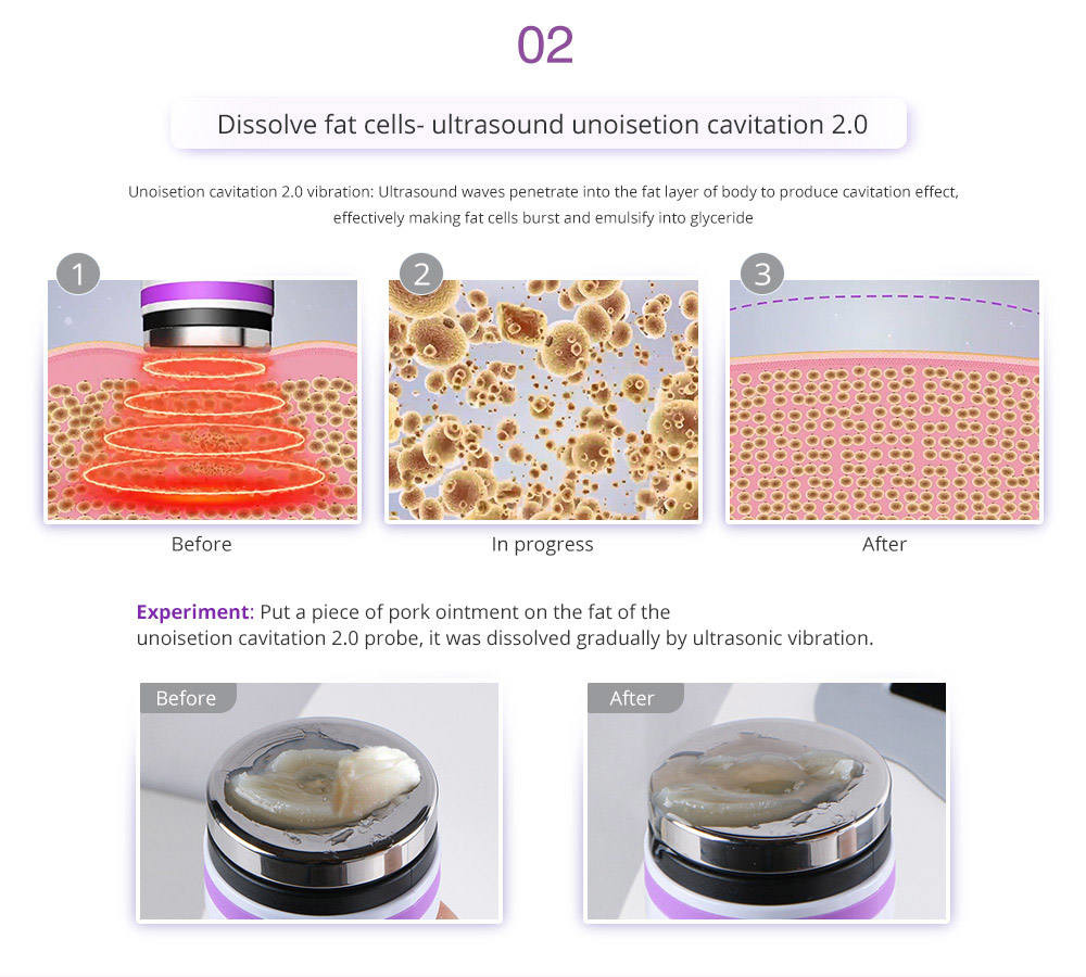 Unoisetion 6 In 1 40k Cavitation Ultrasonic Lipo Laser Body Sculpting Machine