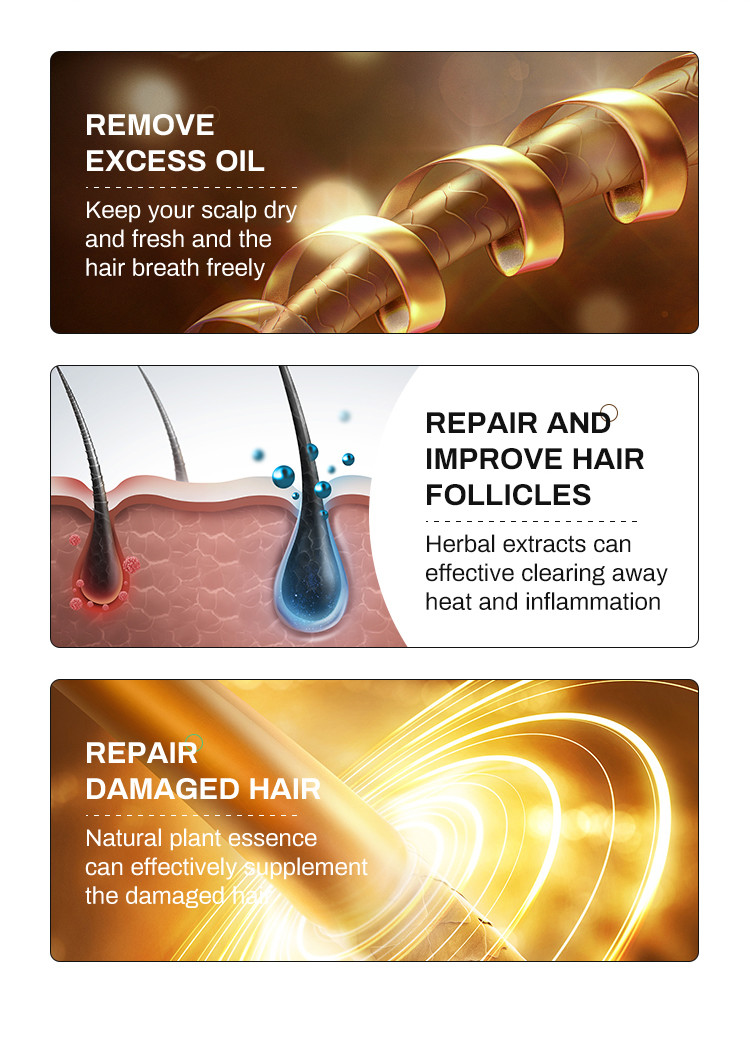 Best Selling Hair Growth Shampoo for Thinning Hair Loss for Women and Men Thicker Longer Hair