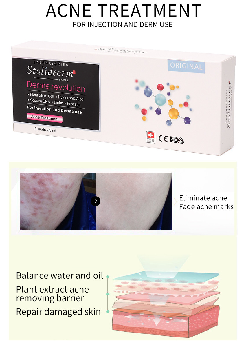 Acne Treatment Essence Serum Injection Use Meso Theraphy Safe Good Effect Serum Set 5pcs/Set