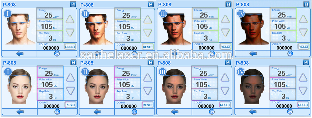 Diode Laser 808 Hair Removal/No Side Effect/ Painless USA 808 diode laser/808nm Diode Laser