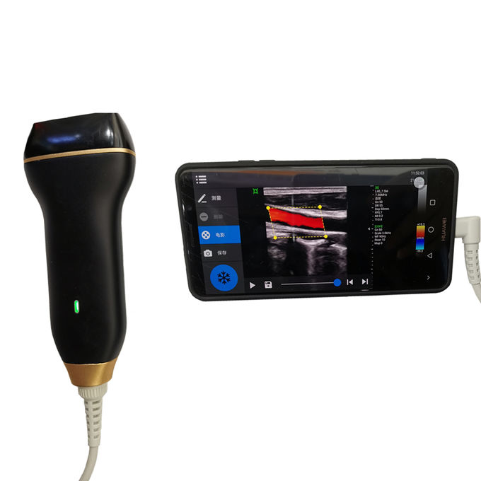 Home Ultrasound Imaging Machine Color Doppler Ultrasound Scanner with USB Connection