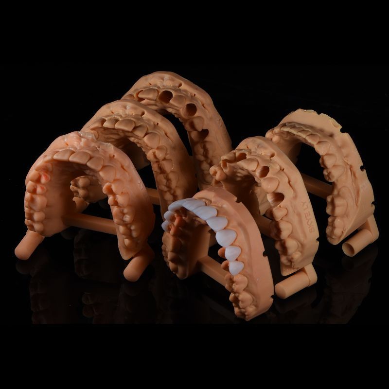 Cosmetic Digital Porcelain Emax Laminate Veneers Customizable