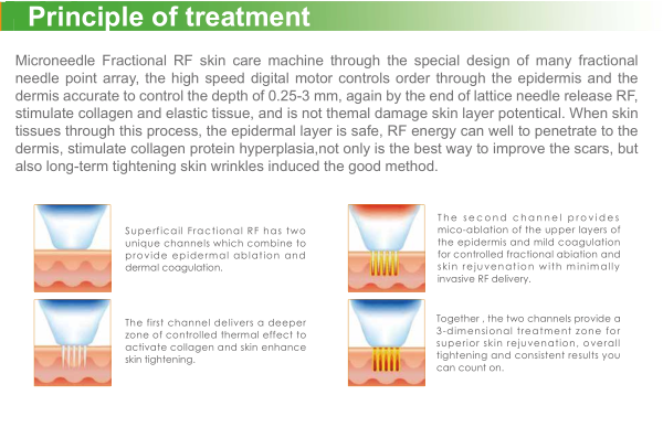 Portable 5mhz Radio Frequency Rf Micro Needling For Anti - Wrinkle Treatment