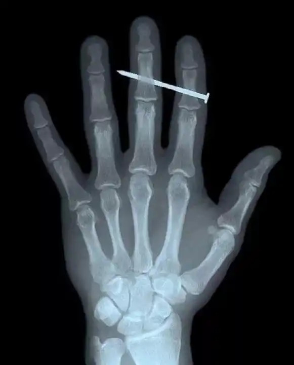 PET Film Base Blue Transparent Color Medical X ray films for X-ray Diagnosis