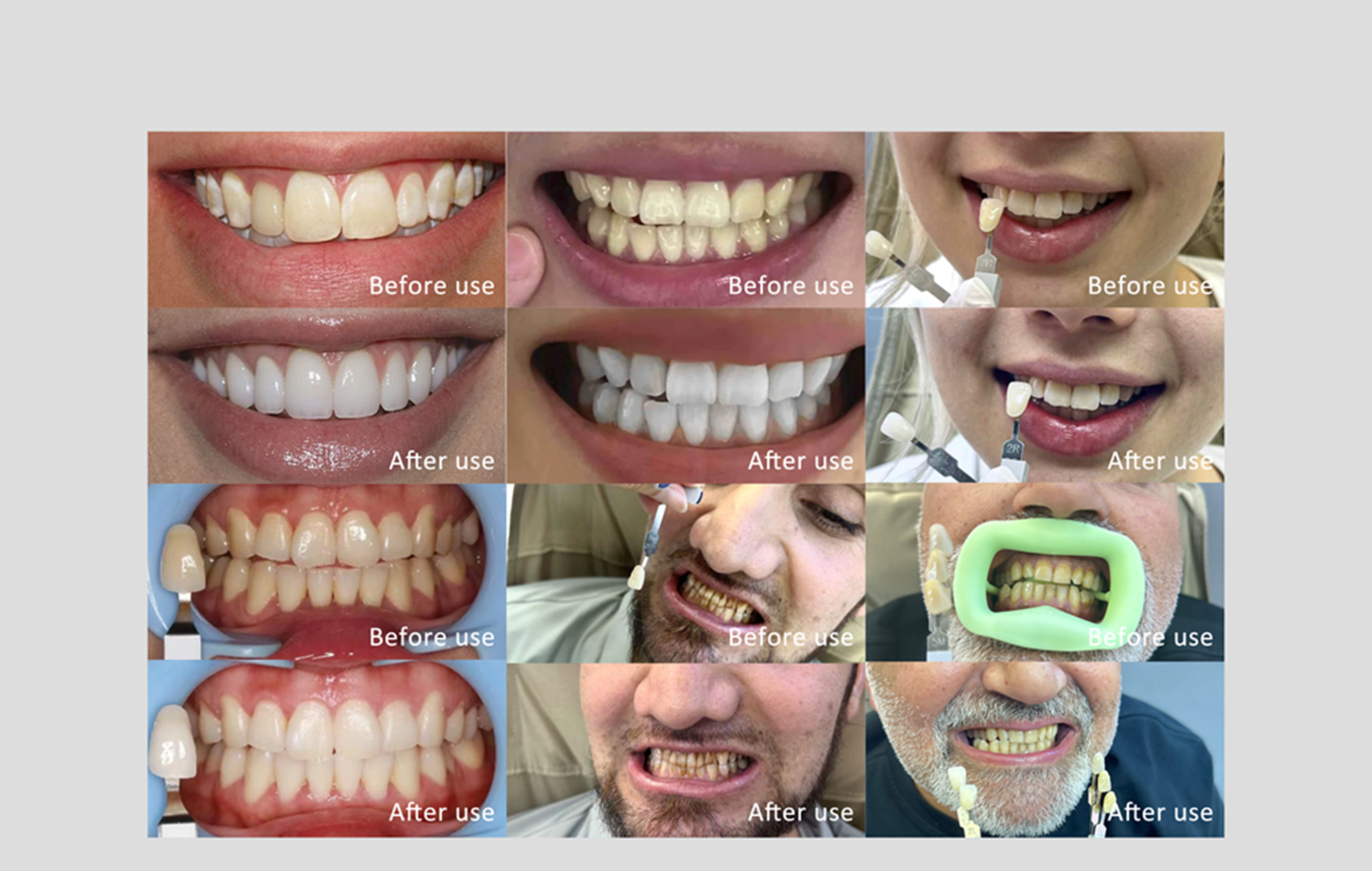 Herbal Extract Gel Teeth Whitening Pen Professional Daily Instant whitening Pen For Daily Home Using Other Whitening Products