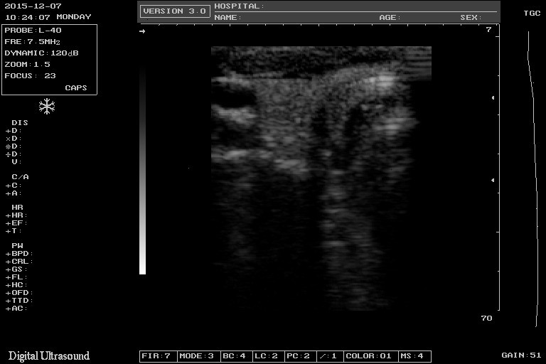 10.4 Inch B Ultrasound Diagnostic System 3.5MHZ Diagnostic Ultrasound Equipment