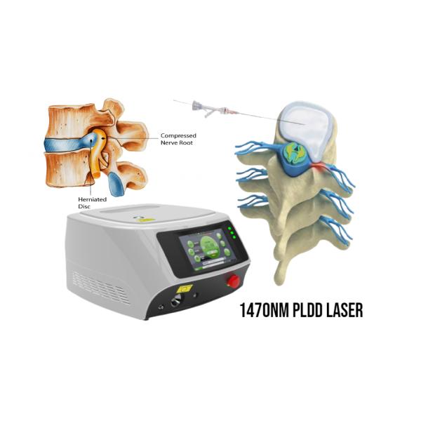 PLDD 980nm Diode Laser