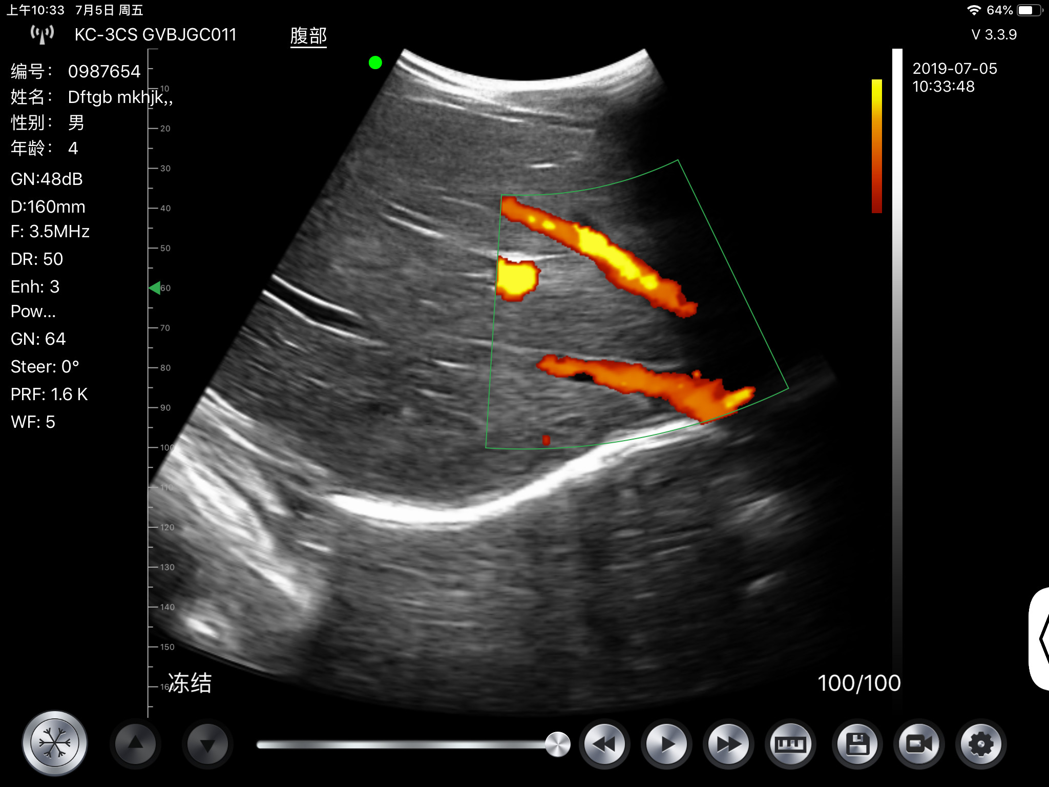 G10cx G10ct Portable Ultrasound Scan Machine Transducer Wireless Doppler Ultrasound Probe