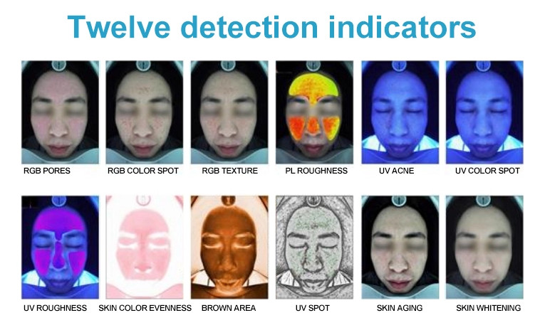 Cosmetics Skin Analysis Machine Facial Skin Tester for Doctor Therapist