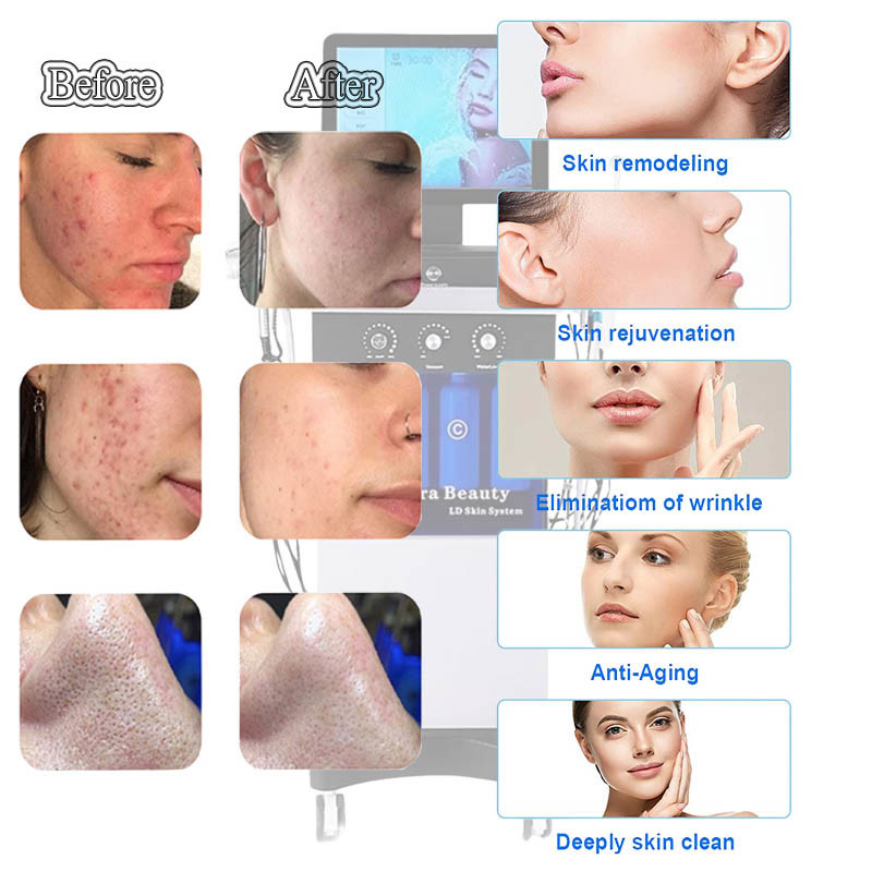 CE H2O2 Hydrafacial Machine Dermabrasion Ultrasound Skin Scrubber Vibration Cleaning Oxygen Jet Peel Machine