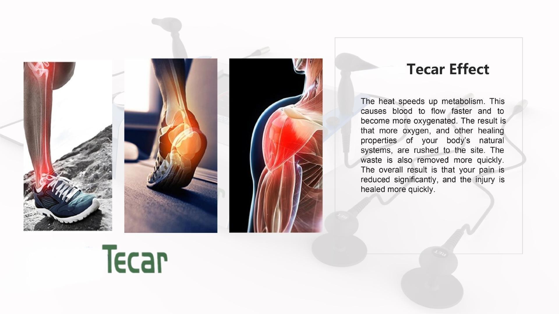 CET RET Tecar Therapy Machine 300W 300-500KHZ For Sports Injury Recovery