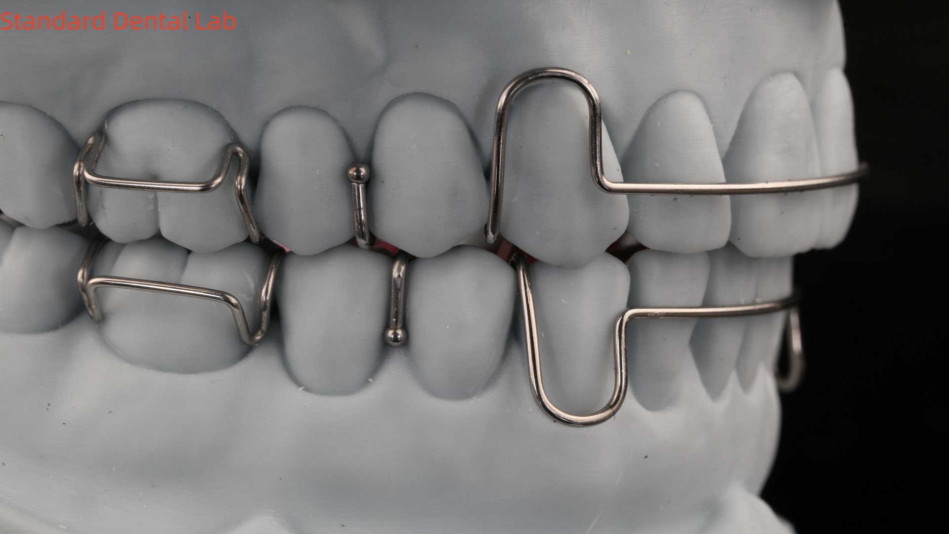 Teeth Expansion And Distalization Orthodontist Palate Expander China Dental Lab