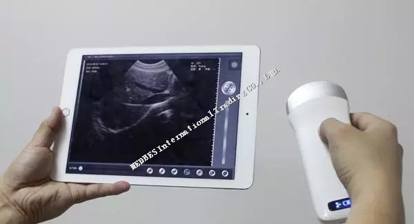 Wireless Convex Probe Iphone connecting Ultrasound Scanner