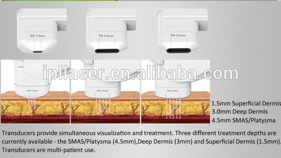 high intensity tighten function hifu for contraction