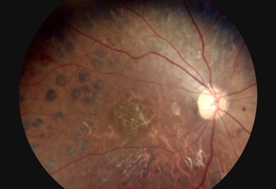 3 Lens Available Ophthalmic Equipment Digital Fundus Camera Eye Surface Camera Eye Anterior Lens Replaceable