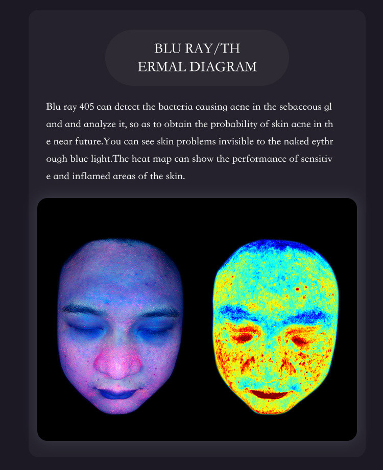 100V-240V Facial Skin Analyzer Machine Comprehensive Skin Evaluation AI Powered Diagnosis