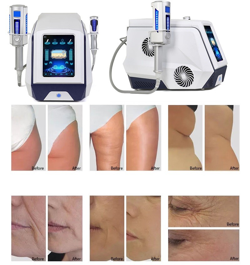 360 Rotating 9d Slim Inner Ball Roller Machine Body Contouring Cellulite Reduction Therapy