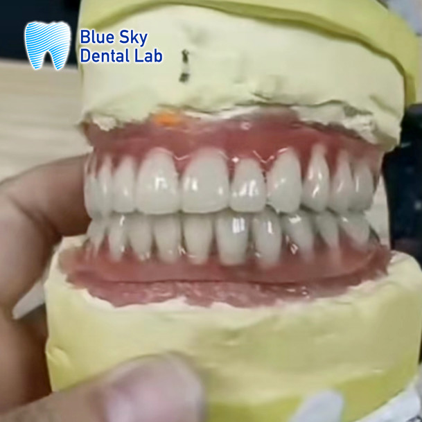Acrylic Denture Dental Titanium Bar With Attachments Silver And Gold