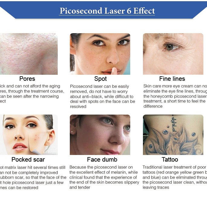 Face Lift 585nm 650nm Picosecond Laser Device 500ps 750ps 2000ps