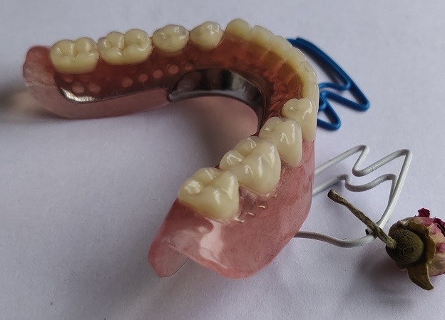 CAD Design Titanium Alloy Partial Denture Metal Framework