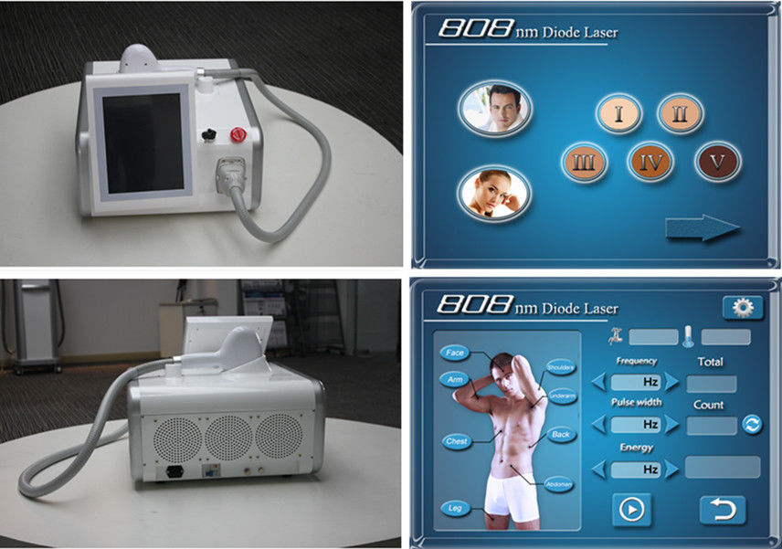 2016 new design 808nm diode laser hair removal machine /hair removal speed 808