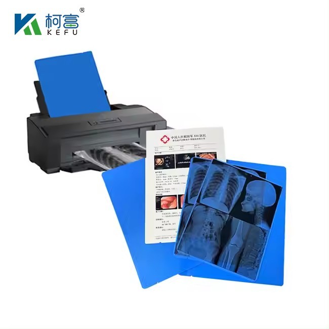 Factory Direct Sale Inkjet Printing X Ray Medical Dry Inkjet X-ray Blue Imaging Film For Medial Devices