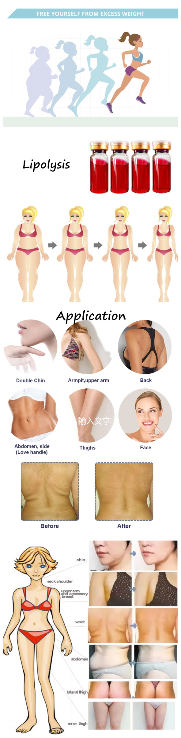 Loss Fat Body Slimming Lipolysis Injection Lipolytic Solution For Fat Dissolving